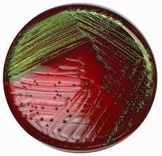 Positive Result= Growth of bacteria with a color change of the colonies that have dark centers (magenta or purple) or a metallic green sheen


Negative Result= Growth of bacteria without color change (takes on media color) or no growth of bacteria