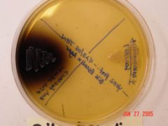 Positive Result= Growth (selective) of bacteria with a color change of the media to black (differential; Bacteria able to hydrolyze esculin and survive the bile salts, often Enterococcus spp.)


Negative Result= Growth of bacteria without color ch...