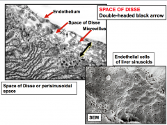 Space
of Disse