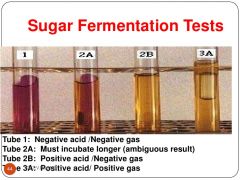 Carbohydrate Fermentation test: