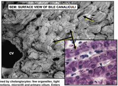 Hepatocytes dump bile into bile canaliculi (ductile network) which eventually reach the bile duct

 Bile is involved in the absorption of fat