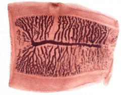 Tipas Platyhelminthes
Klasė Cestoda
Būrys Cyclophyllidea

- gimdos šakos - 17-32 porų

