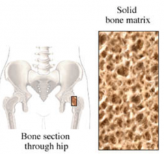 The intercellular substance of bone tissue consisting of collagen fibers, ground substance,  and inorganic bone salts.