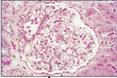  Histology of a normal glomerulus