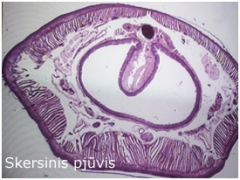 Tipas Annelida
Klasė Oligochaeta

*pilvo nervų grandinėlė, epidermis, žiediniai/išilginiai raumenys, pilvinė kraujagyslė, žarna, metanefridijos(šalina medž. apykaitos produktus), šereliai, celomas, nugarinė kraujagyslė, tiflozolis