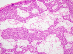 What does this histologic image show?
