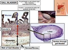 Gallbladder

-Small
pouch that holds bile 

*1. mucosal
folds are tortuous 

*2. huge
smooth muscle (muscularis)

Has a mucosa (epithelium-folds
and lamina propria) 

-Adventitia has loose connective tissue 
-has simple
squamous epithelial...