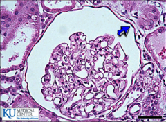 ID the cells indicated by the arrow