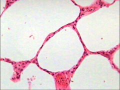 ID the epithelial cells