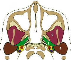 (Number 2 in the picture; parotid space is number 4, and parapharyngeal space is 1)

Masseter muscle
Lateral and medial pterygoid muscles
Ramus and posterior body of mandible
Temporalis muscle tendon
Inferior alveolar nerve (V3)
Internal ma...