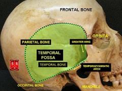 Superior: temporal lines on lateral surface of skull (attachment of temporalis muscle)
Inferior: zygomatic arch
Lateral: temporalis fascia
Medial: skull including pterion