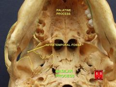 Medial: lateral pterygoid plate with tensor and levator palatini muscles, superior constrictor
Lateral: mandibular ramus, coronoid process
Anterior: infratemporal surface of maxilla
Superior: infratemporal crest bone (sphenoid and temporal bone...