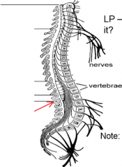 What are the four sections in the spinal cord? Label them: