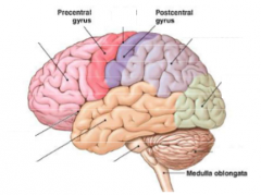 Label the missing parts of the brain