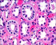 ID the epithelial cells (H&E)