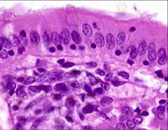 ID the epithelial cell (H&E)