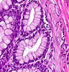 ID the epithelial cell (H&E)