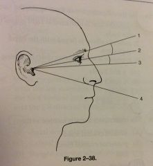Referring to fig 2-38 which of the following positions requires that baseline number 3 be parallel to the IR
A. Parietal natural
B.  PA axial (Caldwell)
C. AP axial (Towne)
D. SMV