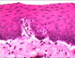 ID the epithelial cell (H&E) - be specific