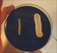 What does this result determine right side bacteria grown on starch agar?
