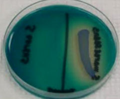 What does this growth pattern on DNase agar indicate?