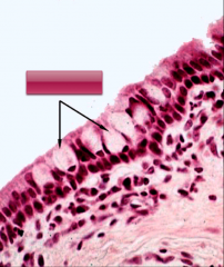 ID the epithelial cell (H&E) - (ignore the arrows & box)