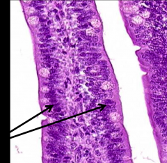 ID the epithelial cell (H&E); specify what the arrows are pointing to