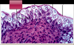 ID the epithelial cell; specify what the black lines are labeling; NOTE. the 2 lines on the R label the same cell type
