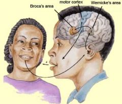 Left hemisphere of the cerebral cortex. 

Broca's aphasia/ expressive aphasia: difficult to enunciate and speak fluently. Still understand others perfectly. Frontal lobe. 

Wernicke's aphasia/ receptive aphasia: difficulty understanding the mea...