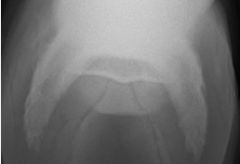 Name the radiographic view