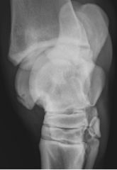 Radiographic view
