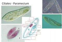 Identify the Macronucleus & micronucleus, oral groove, Cilia, and Vacuoles of this Paramecium: