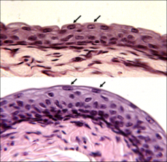What type of epithelial tissue is this? What distinguishes top tissue from the bottom tissue? What does this mean?