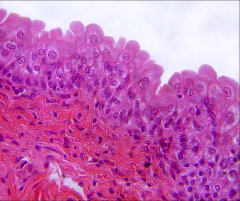 ID the epithelial cell (H&E) and explain how the ID is determined.