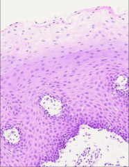 ID epithelial tissue (H&E)
what is the white tissue in the lower right corner?
what is the name for the darkest basophilic band bordering the white region?