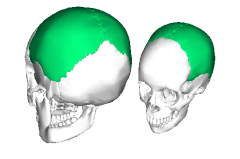 The left and right parietal bones form the largest portions of the roof of the skull and sides of the skull.
