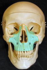 "Upper Jaw"


 


Largest bone in the upper face


 


Has 4 processes (Zygomatic, Palatine, Frontal, Alveolar) and 4 bones ( two zygomatic and two palatine)