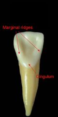 Bulge or elevation located on the cervical third of anterior teeth.
