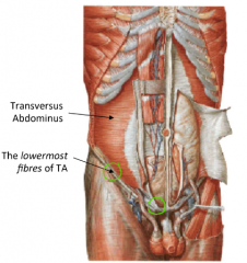 1. Transverse Fibre Arrangement


2. Topmost fibres arise from post. ab wall fascia 

Lowermost fibres arise from lateral 1/3 of the inguinal ligament and arch up



3. Topmost fibres insert on to costal margin 

Lowermost fibres Insert in to same...