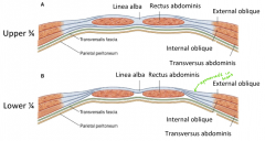 Upper 3/4 of abdomen wall (above arcuate line):
- EO aponeurosis anterior
- IO bifurcates, one layer anterior, one posterior
- TA aponeurosis posterior


Lower 1/4 of abdomen wall (below arcuate line):
- All aponeuroris anterior