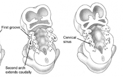 The second arch grows caudally and covers the other arches. A cervical sinus is created. Ectoderm-lined. This sinus can later become a cyst on the sternocleidomastoid.