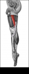 Gracilis- Location: the most superficial muscle on the medial side of the thigh. It is thin and flattened, broad above, narrow and tapering below; Function: Adducts the thigh 









 