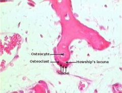 O: osteoblast; H: Howship's Lacunae