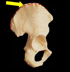 What is this entire bone called?
(Ignore Arrow)