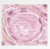 What stage is the following follicle? What epithelium is seen here?
 