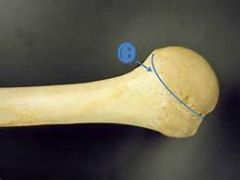 formed by the groove circumscribing the head and separating if from the greater and lesser tubercles
indicates the line of attachment of the glenohumeral joint capsule