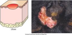 a secondary skin legion.
epidermal damage which exposes the underlying dermis- so heel by scarring.