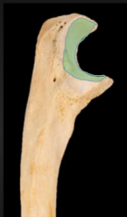 formed by the walls of the olecranon and coronoid process of the ulna