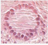 What stage is the following follicle? What epithelium is seen here? 
 