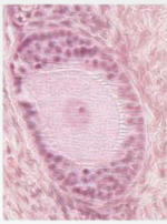 What stage is the following follicle? What epithelium is seen here? Describe what is happening.
 
 